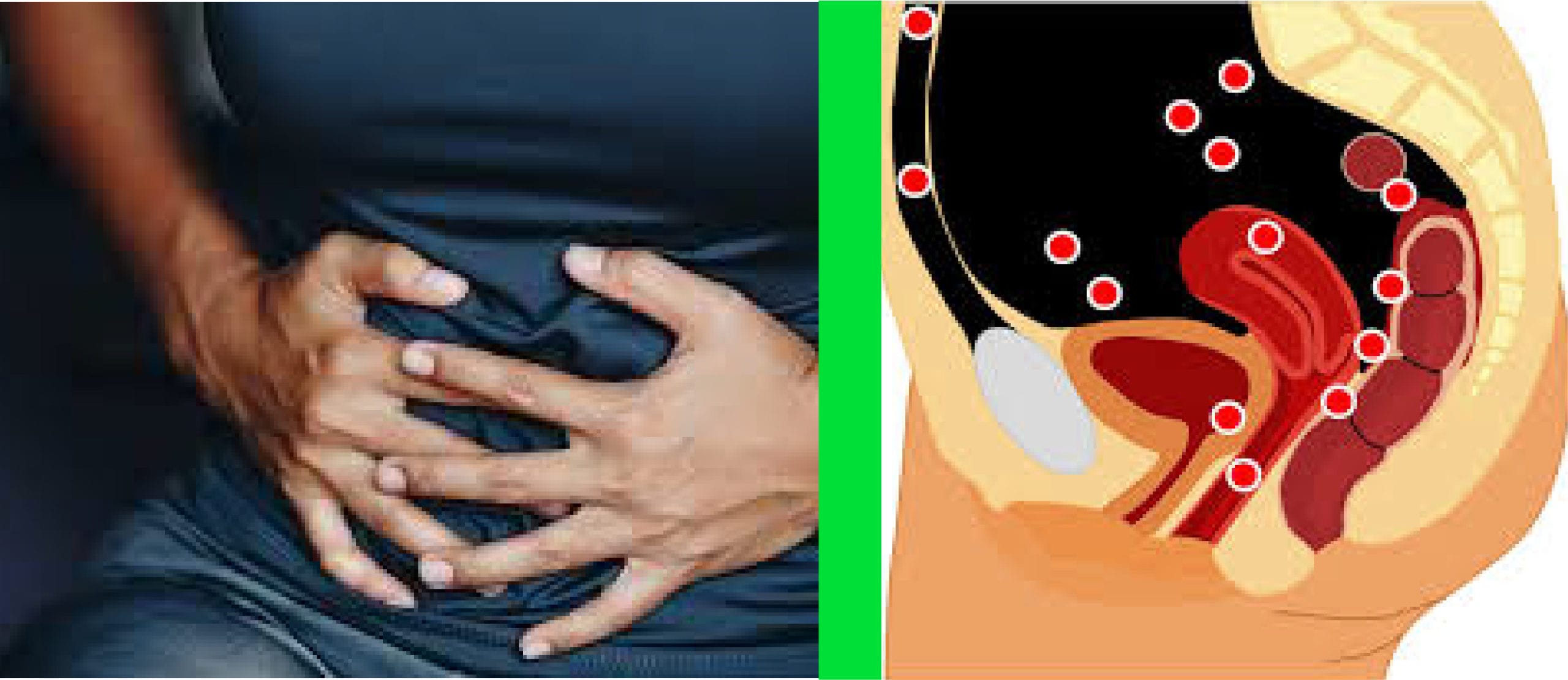 Female Infertility Treatment in Kenya | NUR Fertility