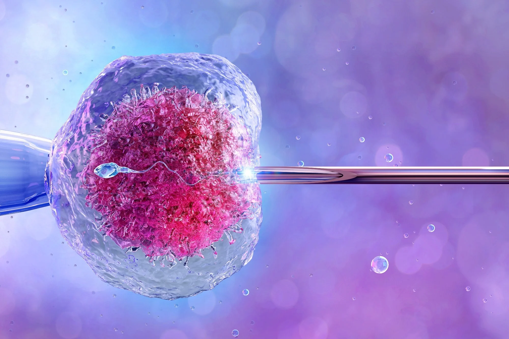 Difference Between IVF and IUI Explained Simply