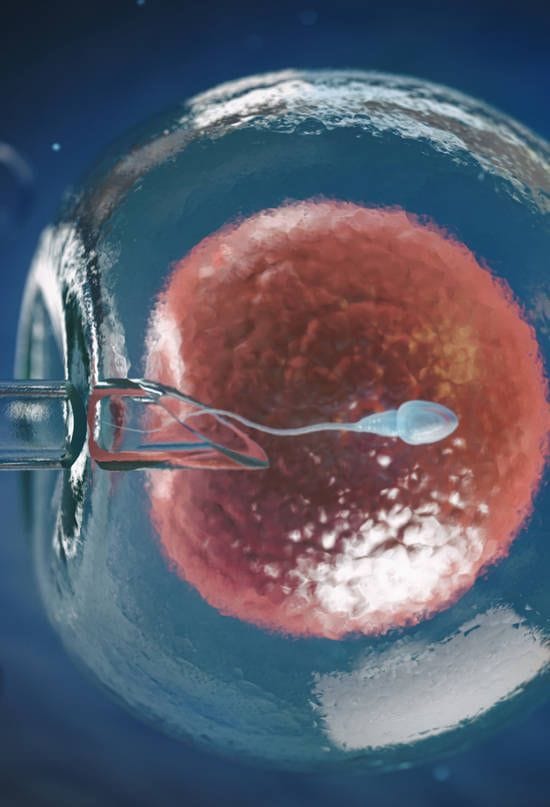 IVF Treatment in Nairobi – High Success In Vitro Fertilization at NUR Fertility